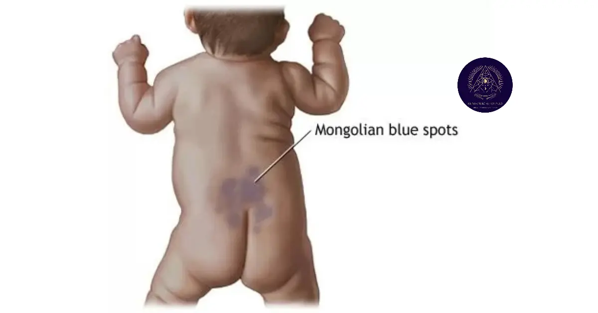 Mongolian Spot Spiritual Meaning