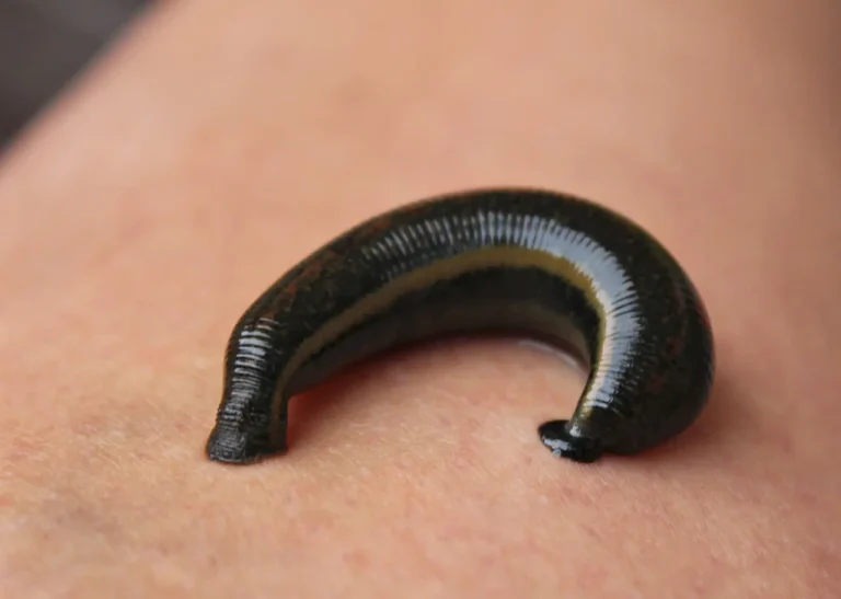 dreams about removing leeches