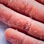spiritual meaning of peeling skin on hands